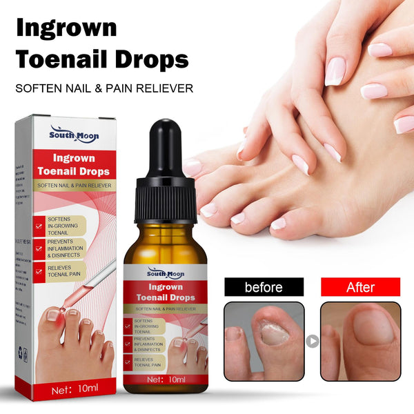 Ingrown Toenail Treatment Serum Nail Correction Recover Oil Pain Reliever Nail Softener Trim with Ease Oil Feet Health Care Safe